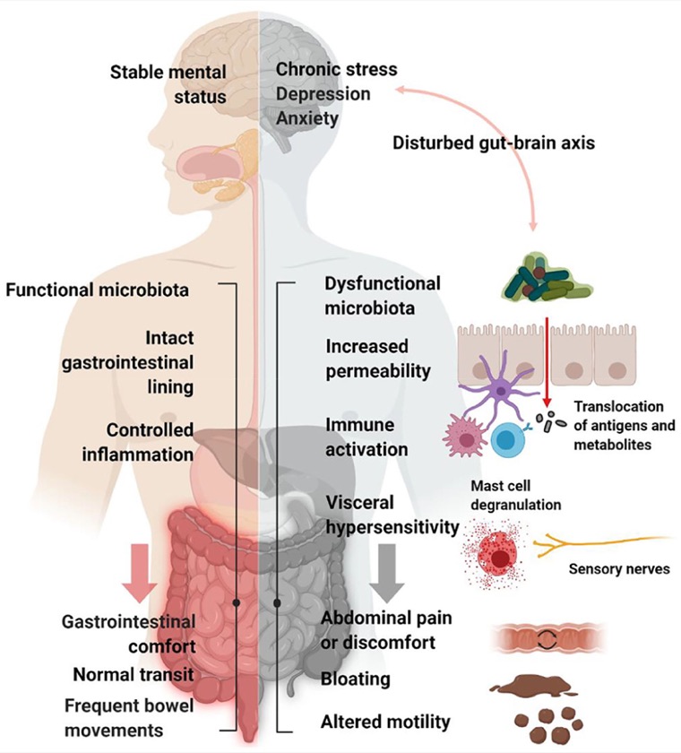 A diagram contrasting a functional and a dysfunctional microbiome and their effects on the gut and the gut–brain axis