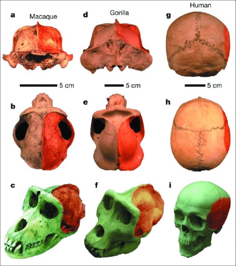 Chewing-muscle attachments compared in a macaque, a gorilla and a human